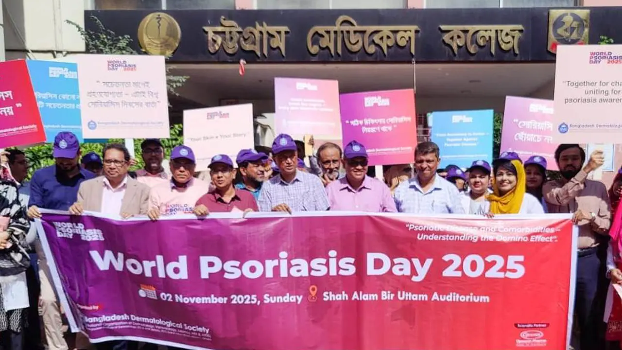 ‘সোরিয়াসিস কেবল ত্বকের রোগ নয়, জটিল নানা রোগের ঝুঁকিও বাড়ায়’