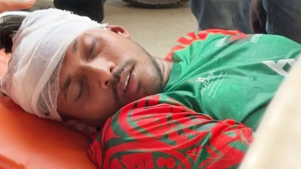 পাকিস্তান ম্যাচে মাথা ফেটে হাসপাতালে বাংলাদেশের খেলোয়াড়