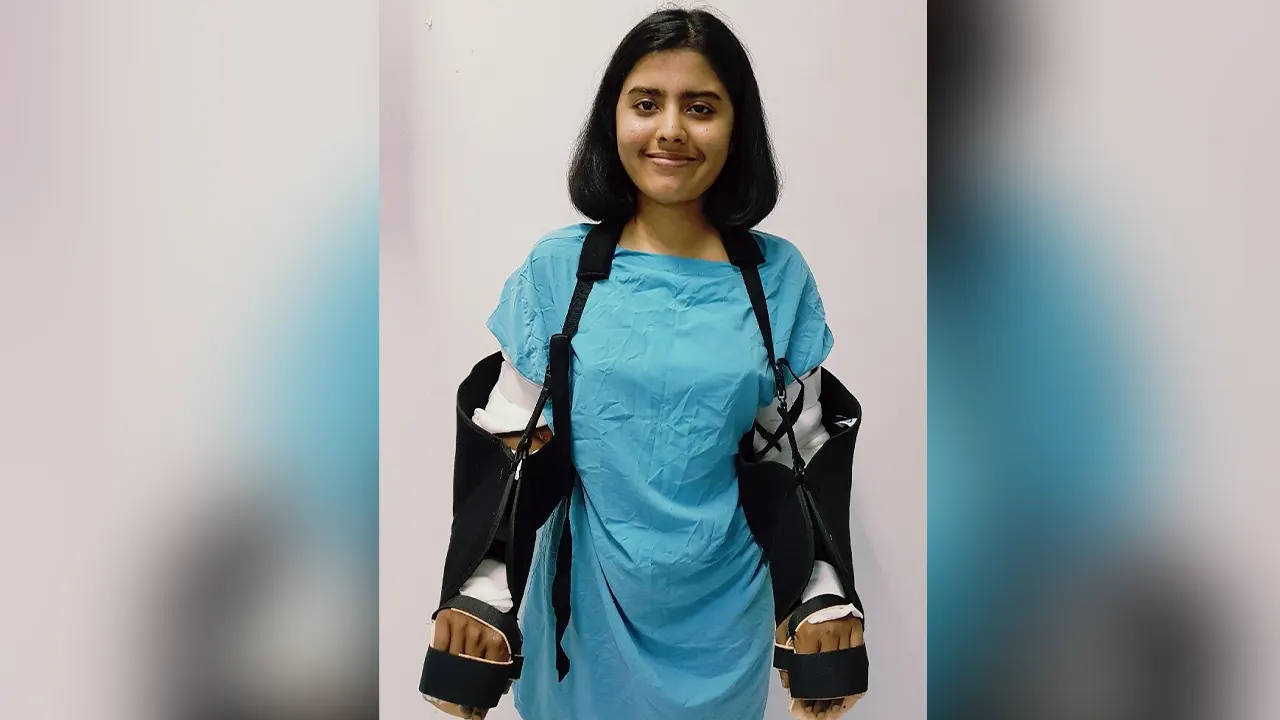 তরুণীর হাতে পুরুষের হাত প্রতিস্থাপণের পর ঘটল অদ্ভুত ঘটনা