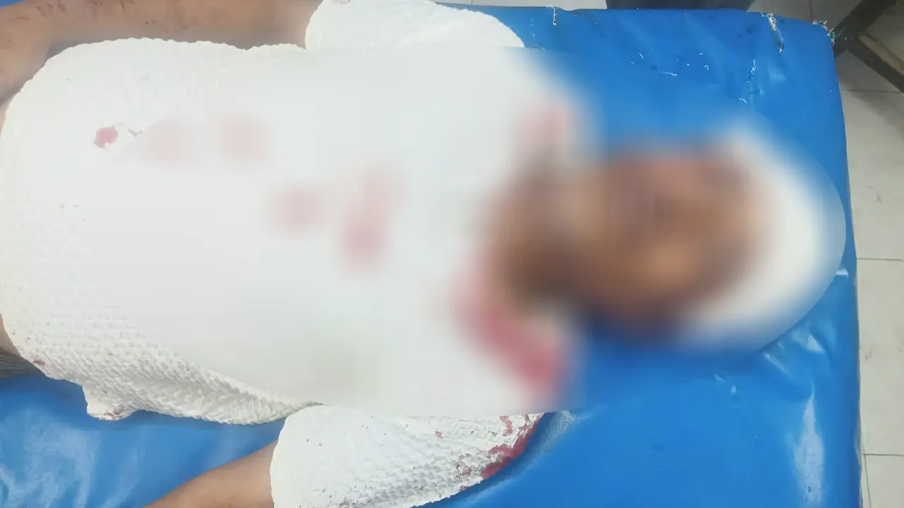 আহত বিএনপি নেতা মনিরুল ইসলাম হাওলাদার। ছবি : কালবেলা