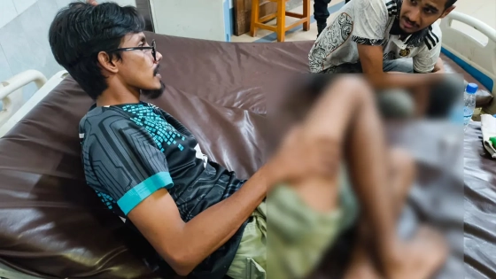 সিলেট ইঞ্জিনিয়ারিং কলেজের শিক্ষার্থীদের পরিচালনায় জুলাই গণঅভ্যুত্থান স্মরণে আয়োজিত জুলাই স্মৃতি ফুটসাল টুর্নামেন্টে হামলার ঘটনায় আহতরা হাসপাতলে। ছবি : কালবেলা