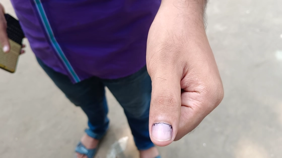 ঘষা দিলেই উঠে যাচ্ছে ‘অমোচনীয়’ কালি